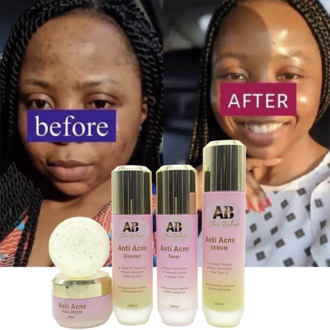 Anti Acne 5-in-1 Set