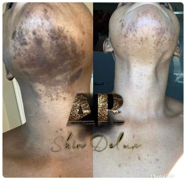 Half Cast Whitening Set